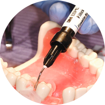 Implant-Retained Prostheses