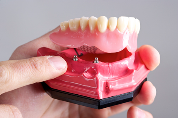 cad cam tray in