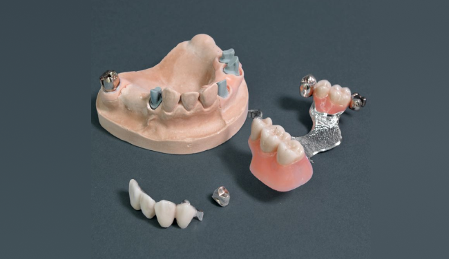 cad cam tray in