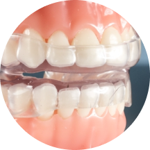 Implant-Retained Prostheses