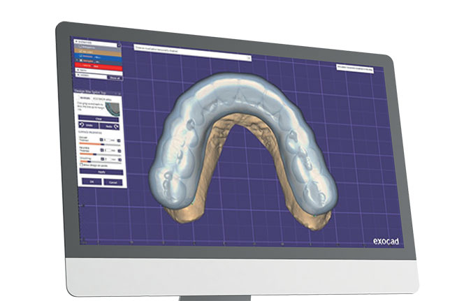 cad cam tray in